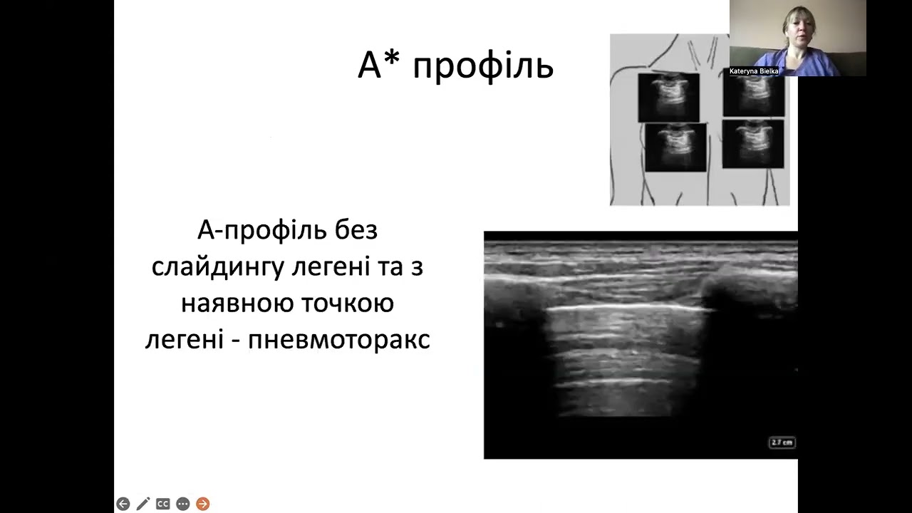 BLUE-протокол