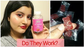 Gummy Bear Hair Vitamins Review Youtube
