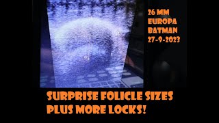 Surprise Follicle Sizes plus more locks and using multis to give borderline girls that extra boost! Wealth