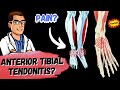 Tibialis Anterior Tendonitis [Tendonitis on TOP of Foot Treatment]