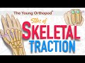 Skeletal Traction Sites | ANIMATION | USMLE | Anatomy, Lecture | NEET PG, MRCS, The Young Orthopod