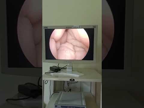 #laparoscopic Karl Storz Image 1 Hub HD
