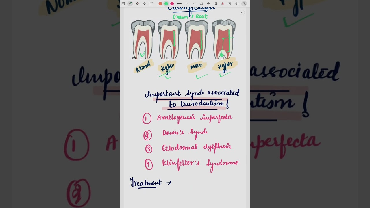 WHAT IS BULL'S TEETH ??  🦷🦬  ||  TAURODONTISM  || JUST IN 2 MINUTES WITH PICTURES