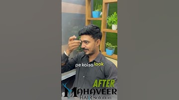 Mirage Hair Patch | Natural Hair Line Patch | Hair Patch For Men #hairpatch #hairpatchservice