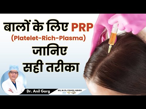 बालों के लिए PRP की सच्चाई - जानिए सही तरीका 