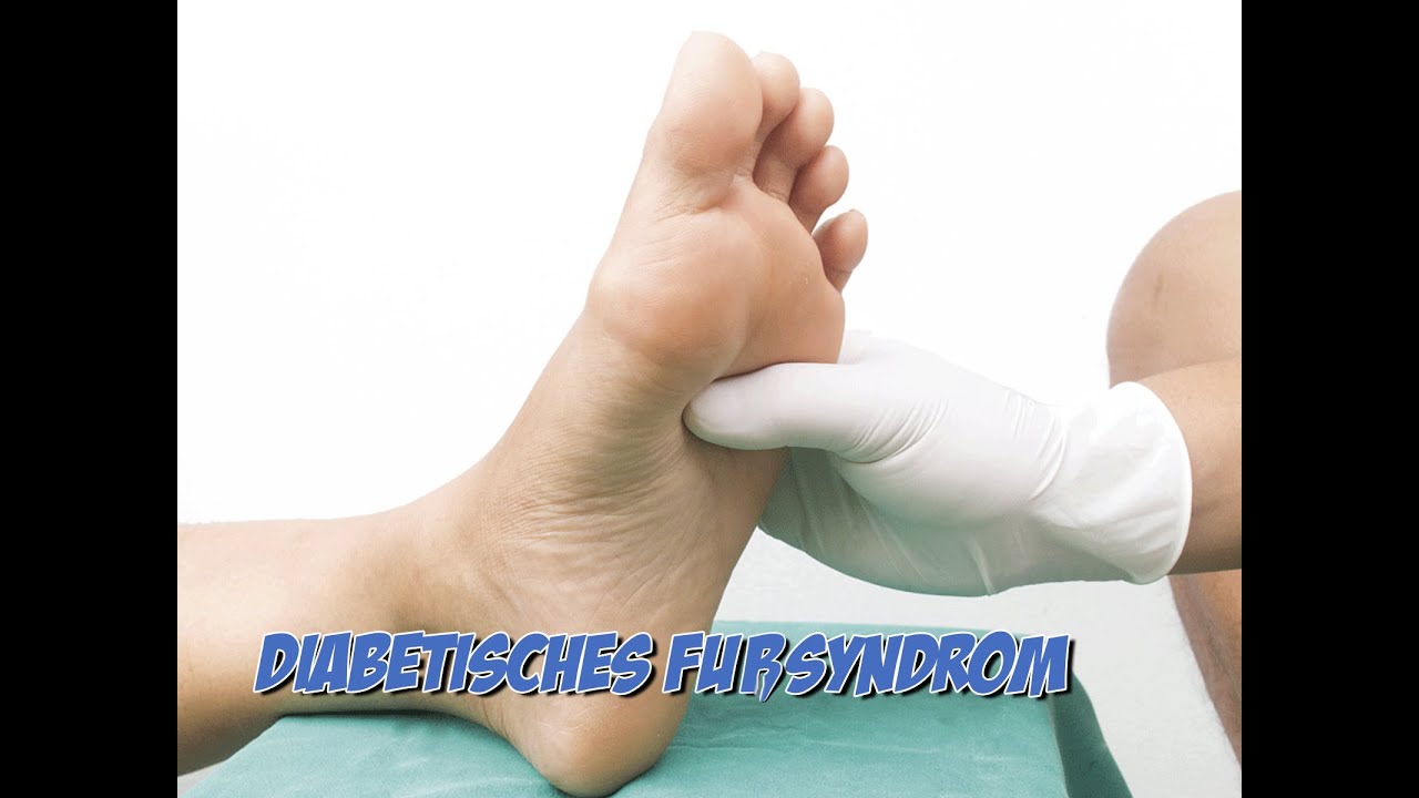 Diabetisches Fußsyndrom | Krankheitslehre | Pflege Kanal - YouTube