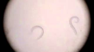 video giun lươn trên kính hiển vi