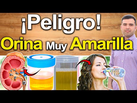 Video: ¿La orina debe ser amarilla?