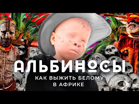 Альбиносы в Африке: притеснение белых в Сенегале | Людоеды, колдуны и плохая медицина