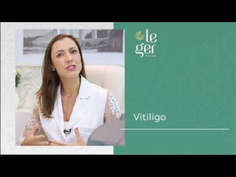 Vitiligo