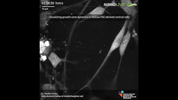 Real-time growth cone dynamics captured using Nanolive