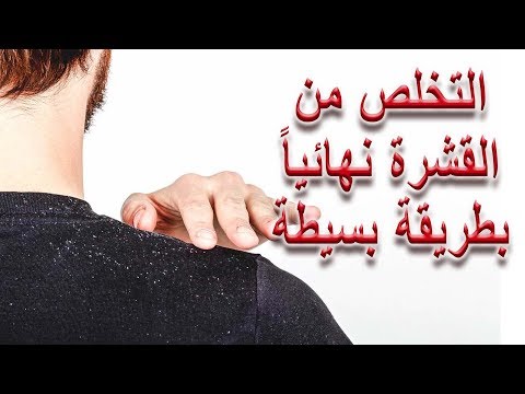 علاج قشرة الشعر والتهاب الجلد الدهني