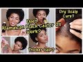 JBCO For A Healthy Scalp & Thicker Hair- Does It Work? - Review + Hair Update - 4C Natural Hair