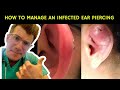 How to recognise, manage and treat an infected ear piercing | Doctor O'Donovan explains...
