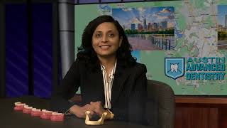 Mini Dental Implants w/ Dr. Saxena in Austin, TX