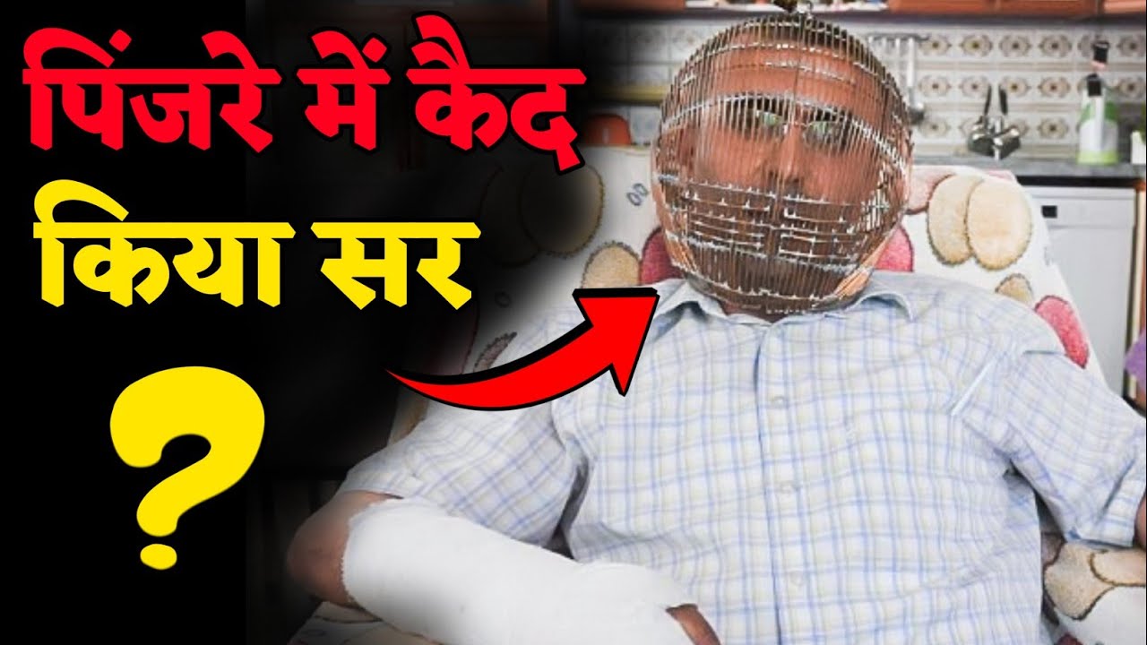 इस आदमी ने क्यों किया अपने सिर को पिंजरे में कैद?|| Real image of batman?|| Amazing facts