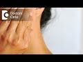 What time does it take for extraction site to heal after tooth removal? - Dr. Srivats Bharadwaj