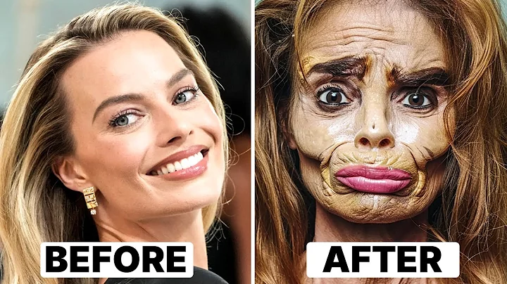 20 Celebrity Plastic Surgery Disasters