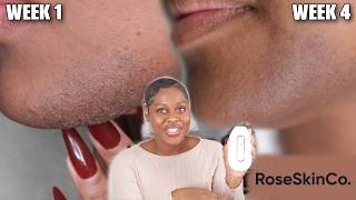 I TRIED LUMI 2 IPL ON MY PCOS CHIN HAIR 🧔🏾‍♀️ Ft RoseSkinCo