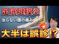 【足底腱膜炎・足底筋膜炎】治らないかかとや足裏の痛み、原因は『腰と神経』！偽物の見分け方と神経フロッシング奥義