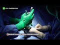 ZSR 2.0 Stapler Circumcision + Glans Penis Injection | Complete procedure