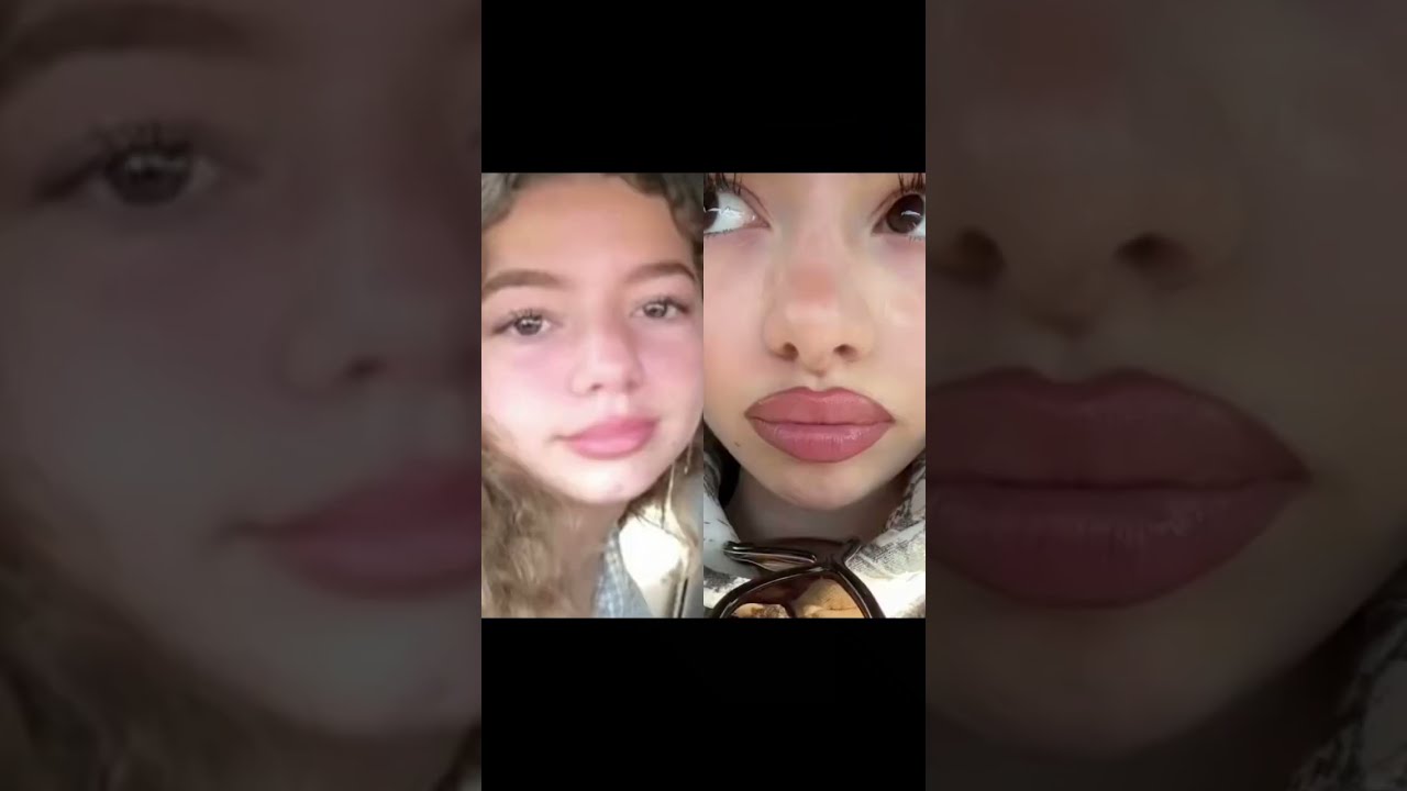 What Plastic Surgery The Kalogeras Sisters Got Kalogerasisters