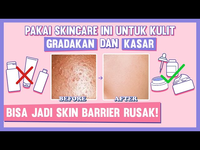 Skincare Routine untuk Memperbaiki Skin Barrier Rusak + Rekomendasi Produknya! class=