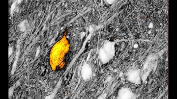 Brain network seen by SUSHI