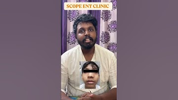 Nasal bleeding/Epistaxis #ent #education #scope #nosebleed #causes