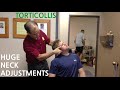 EXTREME neck pain & TORTICOLLIS are GONE with HUGE NECK ADJUSTMENT's @SoCalChiropractic