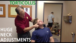 EXTREME neck pain & TORTICOLLIS are GONE with HUGE NECK ADJUSTMENT's @SoCalChiropractic