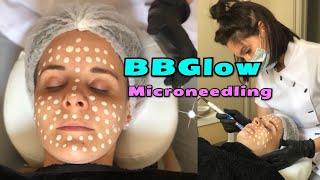 Comment fonctionne BBGlow? Visage complet de maquillage permanent!