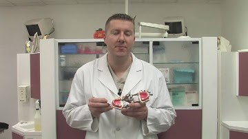 Dental Gold : What Is in Gold Dental Crowns?