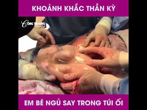 Video: Em bé có thể sinh ra với túi ối còn nguyên vẹn không?