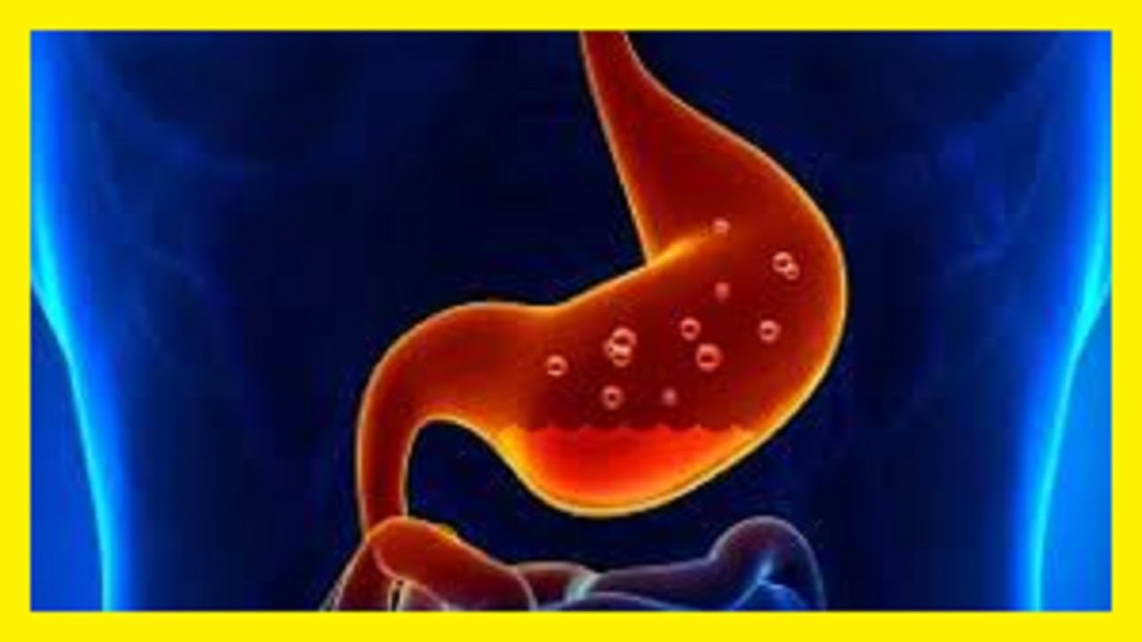 Remedii naturale pentru aciditate și arsuri la stomac