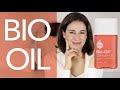 BIO OIL Review para estrías y manchas ¿Vale la pena?, by Miriam Llantada.