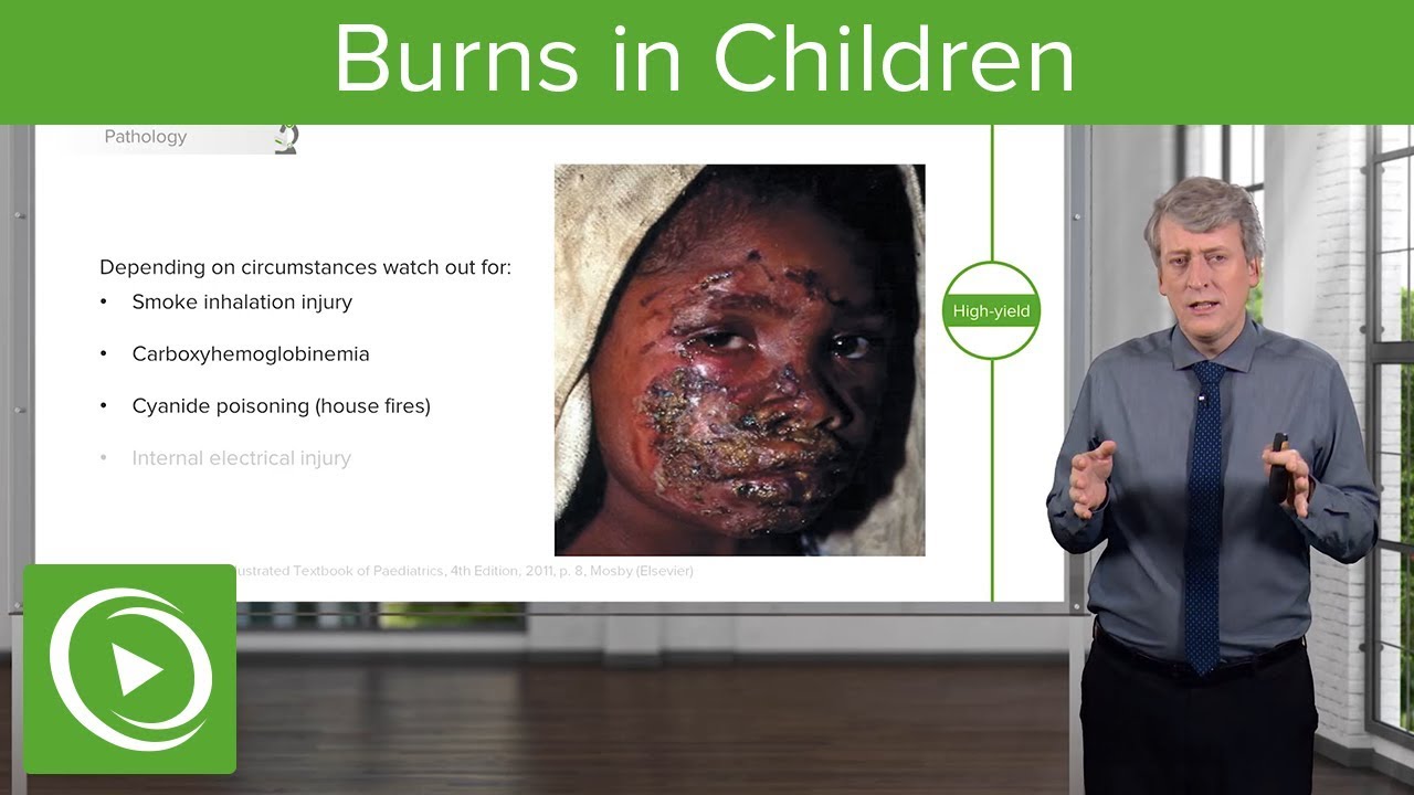 Burns in Children Pediatrics Lecturio YouTube