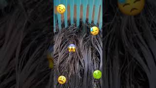 Basmi Kutu Rambut dan Telurnya Sampai Tuntas