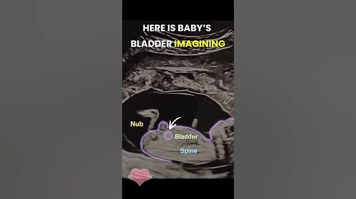 Gender reveal with NubX!