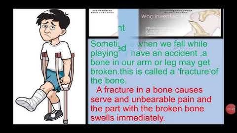 Std :6.Sub : Science.Ls.no.8. Our Skeleton System and the Skin
