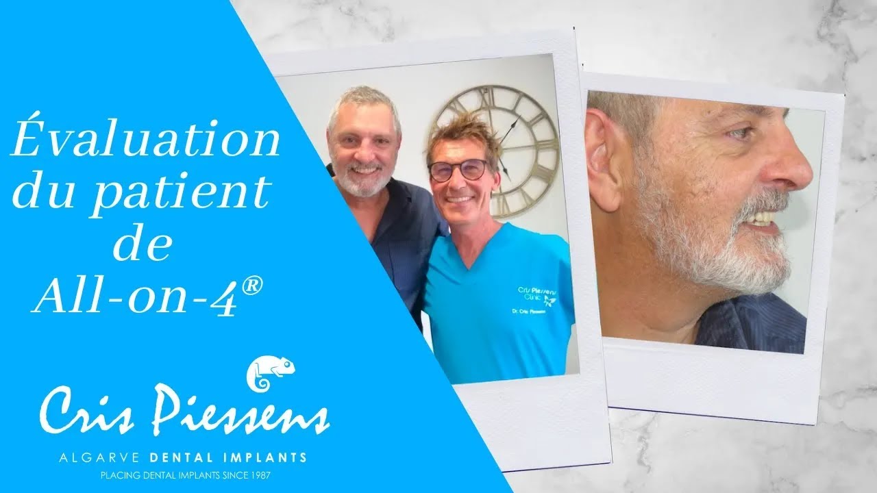 Évaluation du patient de All-on- 4 (Implants dentaires) | Dr Cris Piessens (FR)