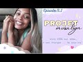 Projet invisalign  ep1 mon histoire premier rdv et explications 