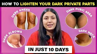 How To Lighten Your Dark Private Parts in JUST 10 DAYS | Vagina & Underarms | Upasana Ki Duniya