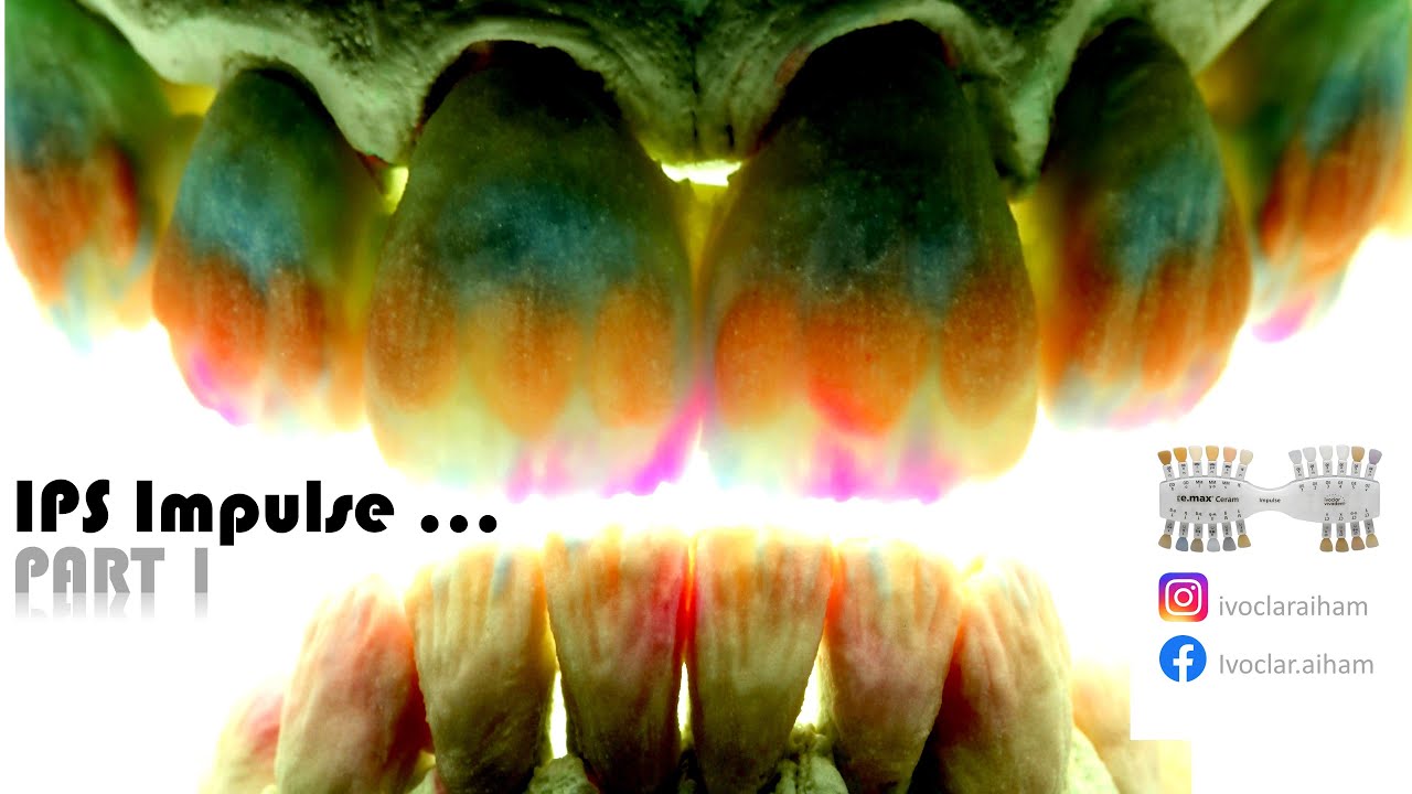 IPS Impulse PART 1