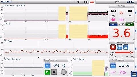 How to setup non invasive hemodynamic monitoring using LiDCO