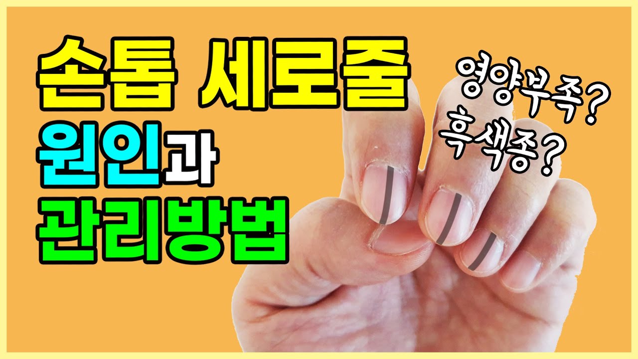 손톱 세로줄/검은줄/갈라짐 :: 영양부족? 흑색종? 원인과 해결방법