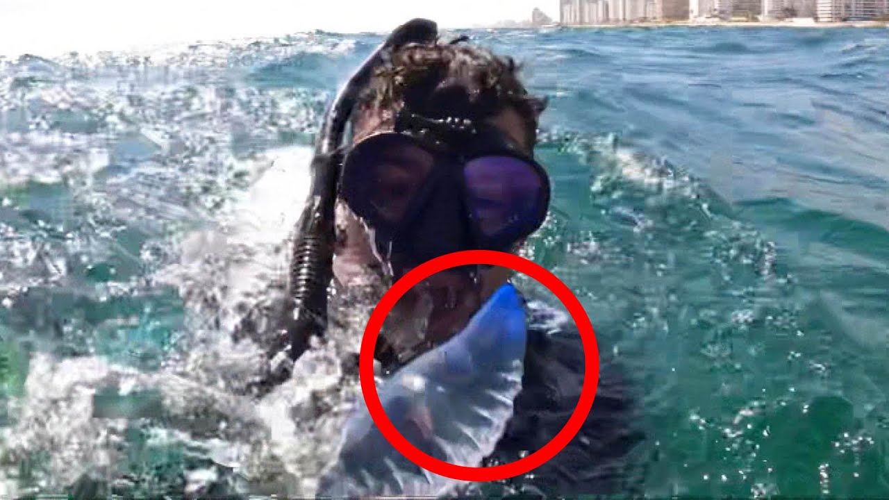 Poisonous Man O’ War Jellyfish Sting Spring Breakers YouTube