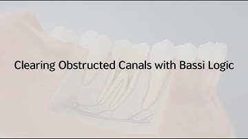 Clearing Obstructed with Bassi Logic - using "the Joker" 15/.05