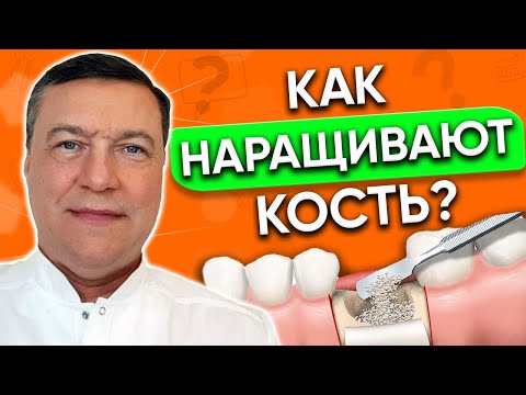 Наращивание костной ткани для ИМПЛАНТАЦИИ зубов