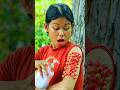 SMART Jungle Survival Idea 😱 Dangerous Bugs Removed in Seconds! 🌿🧴 #shorts